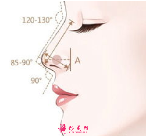 自體軟骨隆鼻哪里做得比較好