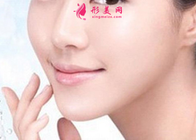 自體脂肪填充臉部多少天可以消腫