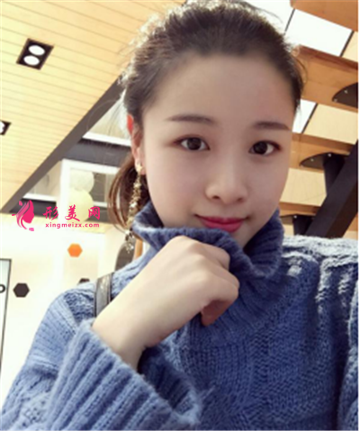 福州種植發(fā)際線術(shù)后恢復(fù)情況分享