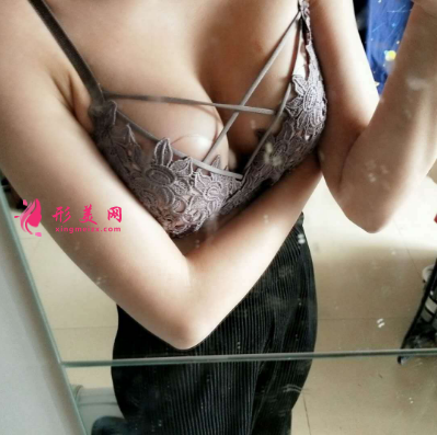 嬌點(diǎn)醫(yī)學(xué)美容醫(yī)院隆胸案例 術(shù)后65天效果圖分享