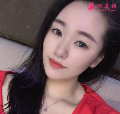 長(zhǎng)虹醫(yī)療分享光子嫩膚真實(shí)案例 術(shù)后94天效果圖