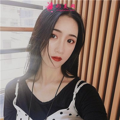 廈門全切雙眼皮手術(shù)術(shù)后效果分享