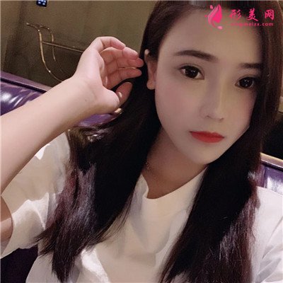 南寧小姐姐全切雙眼皮手術術后恢復情況對比