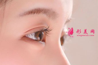 埋線雙眼皮多久可以化妝