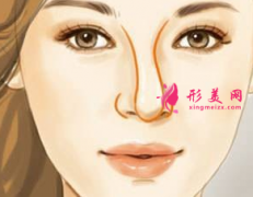 假體隆鼻歪斜了還能矯正嗎？