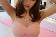 假體隆胸手術切口在哪里？