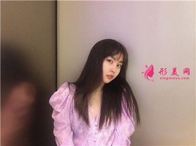 濟南眼部綜合手術(shù)術(shù)后效果展示