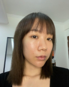 上海九院王濤醫(yī)生鼻綜合案例，隆鼻之后改變真的太大