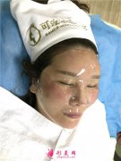 廣州華美醫(yī)療美容醫(yī)院注射水光針術(shù)后恢復(fù)效果反饋