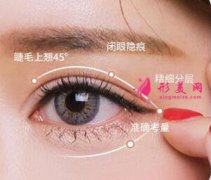廣州切開(kāi)雙眼皮哪里比較好？