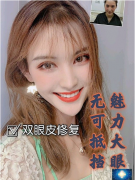 合肥壹加壹雙眼皮修復案例，現(xiàn)在素顏都好看