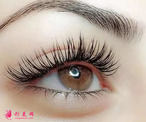 開(kāi)眼角手術(shù)什么時(shí)候能拆線