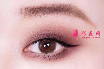 開眼角術(shù)后的效果明顯嗎
