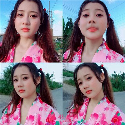 鄭州吸脂瘦臉手術術后效果對比