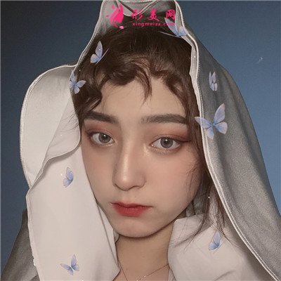成都小姐姐全切雙眼皮術(shù)后恢復(fù)效果展示