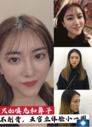 重慶聯(lián)合麗格做的鼻子和面部填充，時(shí)尚耐看，美美噠女神范~