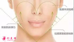 自體脂肪填充臉部是怎么收費(fèi)的？