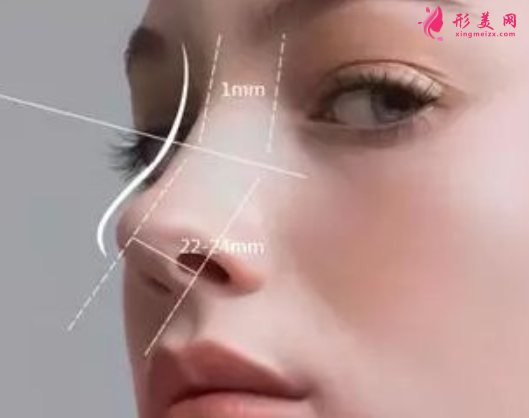 自體軟骨隆鼻適合什么人