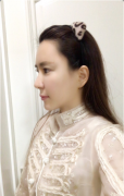 北京南加醫(yī)療美容唐道臣種植發(fā)際線怎么樣？種植案例一覽