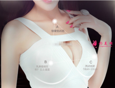 自體脂肪隆胸術前要注意什么？