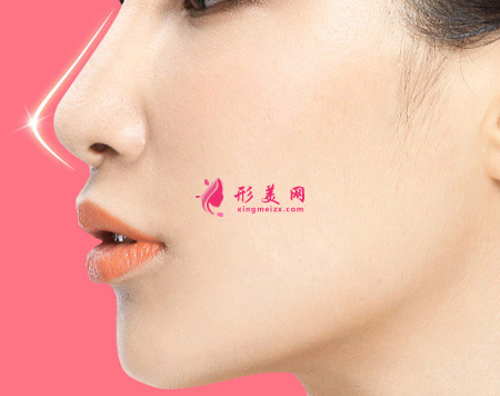 自體軟骨隆鼻選擇哪里的軟骨比較好
