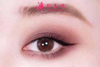 開(kāi)眼角術(shù)后有疤痕怎么辦