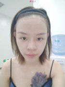 碧蓮盛醫(yī)療美容植發(fā)好不好？植發(fā)的效果能保持多久？