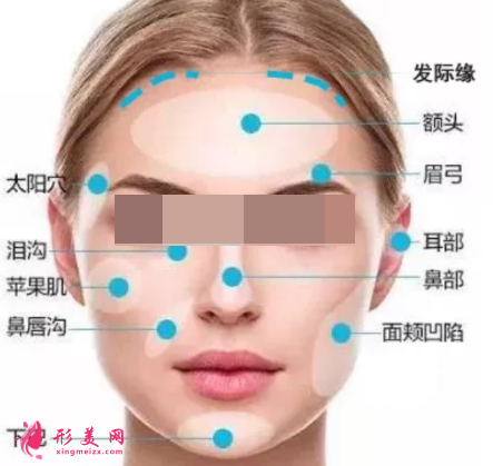 自體脂肪填充臉部有哪些風(fēng)險呢