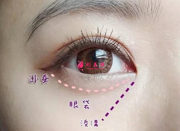 有眼袋了怎么辦啊