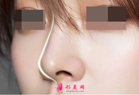 塌鼻子怎么變挺啊