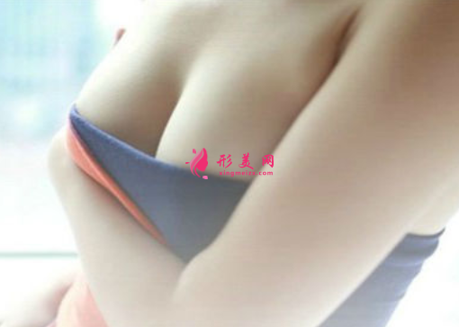 假體隆胸怎么樣啊