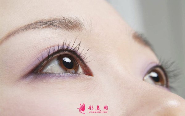 雙眼皮手術(shù)了修復(fù)難度大嗎