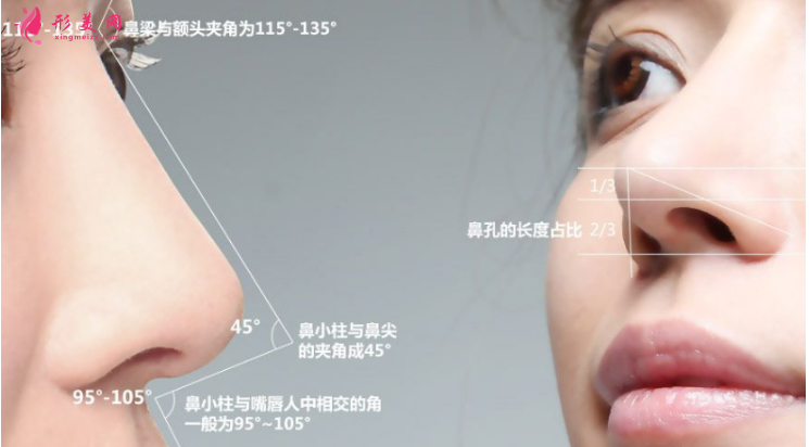 假體隆鼻以后還需要更換嗎