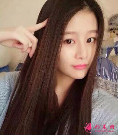 #術前了解#熱瑪吉除皺能維持多久？效果好不好呢？