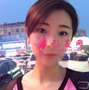 botox瘦腿針的價格是多少？有哪些優(yōu)勢？