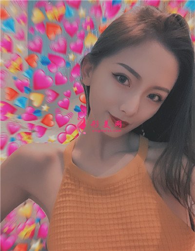 長沙小仙女肋軟骨隆鼻術后效果分享