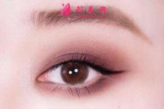 開眼角手術(shù)需要的費(fèi)用是多少？