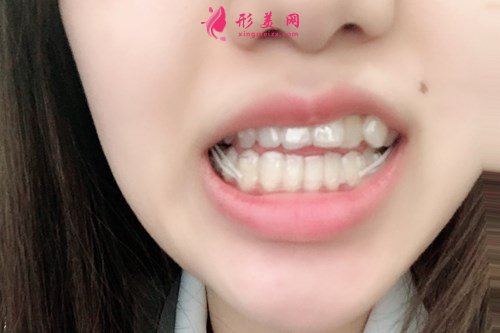 92d5850c1412-audio.jpg 92d5850c1412-audio.jpg