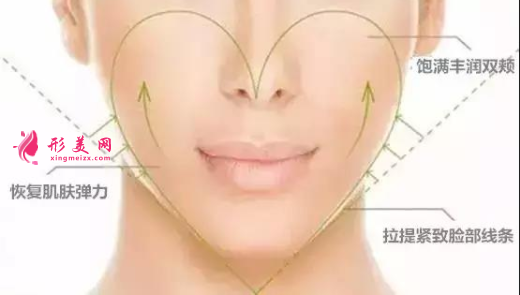 自體脂肪填充面部安全么