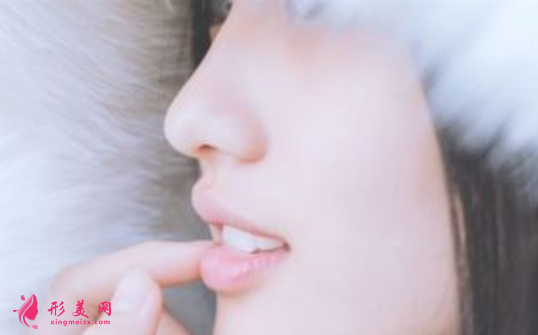 自體軟骨隆鼻價格費用是多少