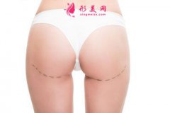 臀部吸脂術后的護理事項