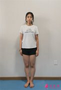 重慶曹陽麗格水動力吸脂瘦大腿術后效果對比