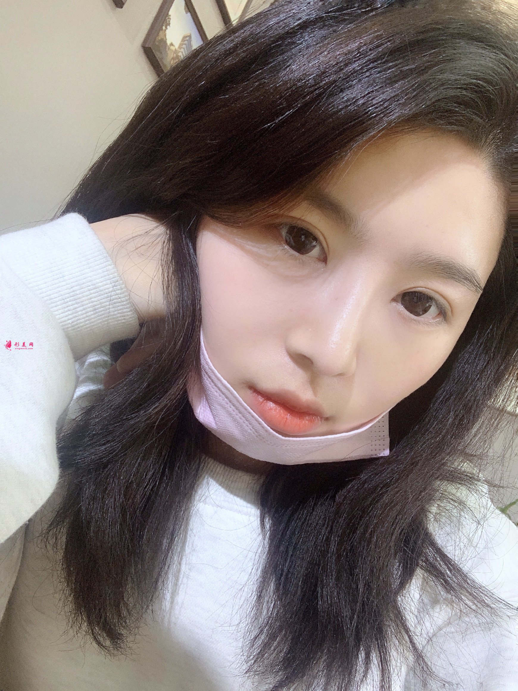 案例圖片