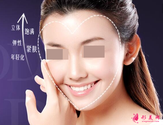 自體脂肪填充臉部效果自然嗎