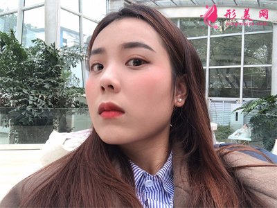 杭州皮秒激光術(shù)后恢復情況對比