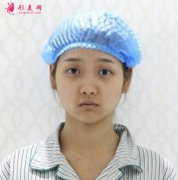 北京潤(rùn)美玉之光整形醫(yī)院做雙眼皮多少錢？術(shù)后恢復(fù)日記分享