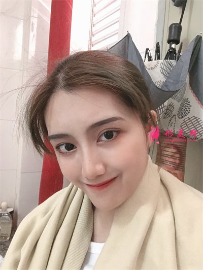 杭州小仙女齊全雙眼皮術(shù)后恢復(fù)情況對(duì)比