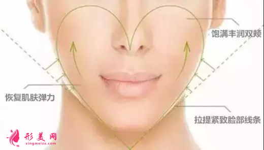 自體脂肪填充面部多久可以洗臉
