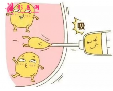 吸脂減肥的恢復(fù)期是多久？