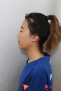 發(fā)育晚沒(méi)有胸，在上海美萊美容院做完隆胸終于像女人了